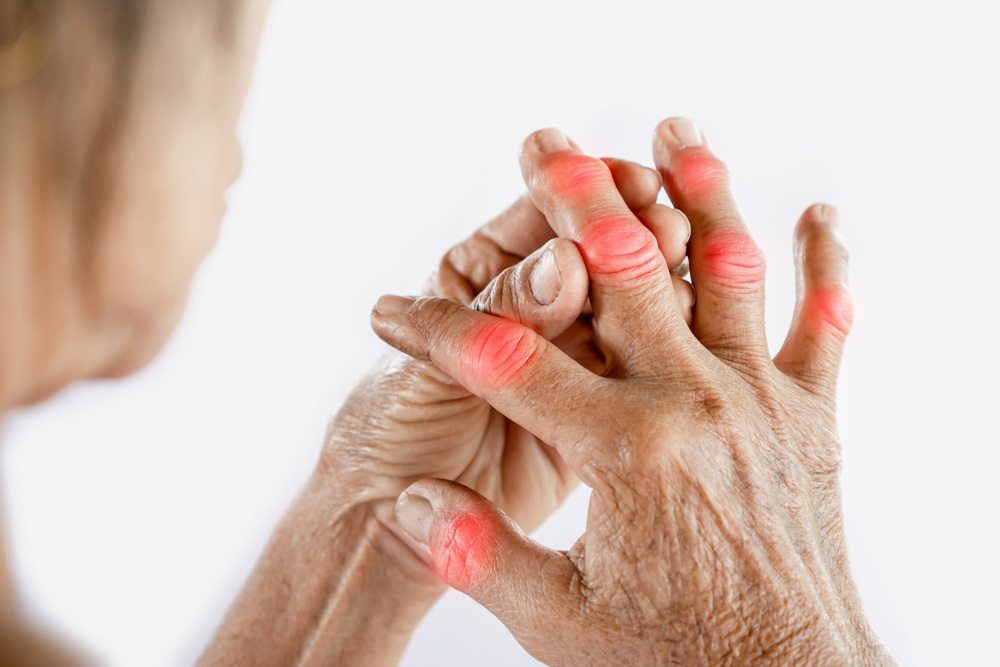 Don't Wait to Talk to Your Doctor About Rheumatoid Arthritis Pain